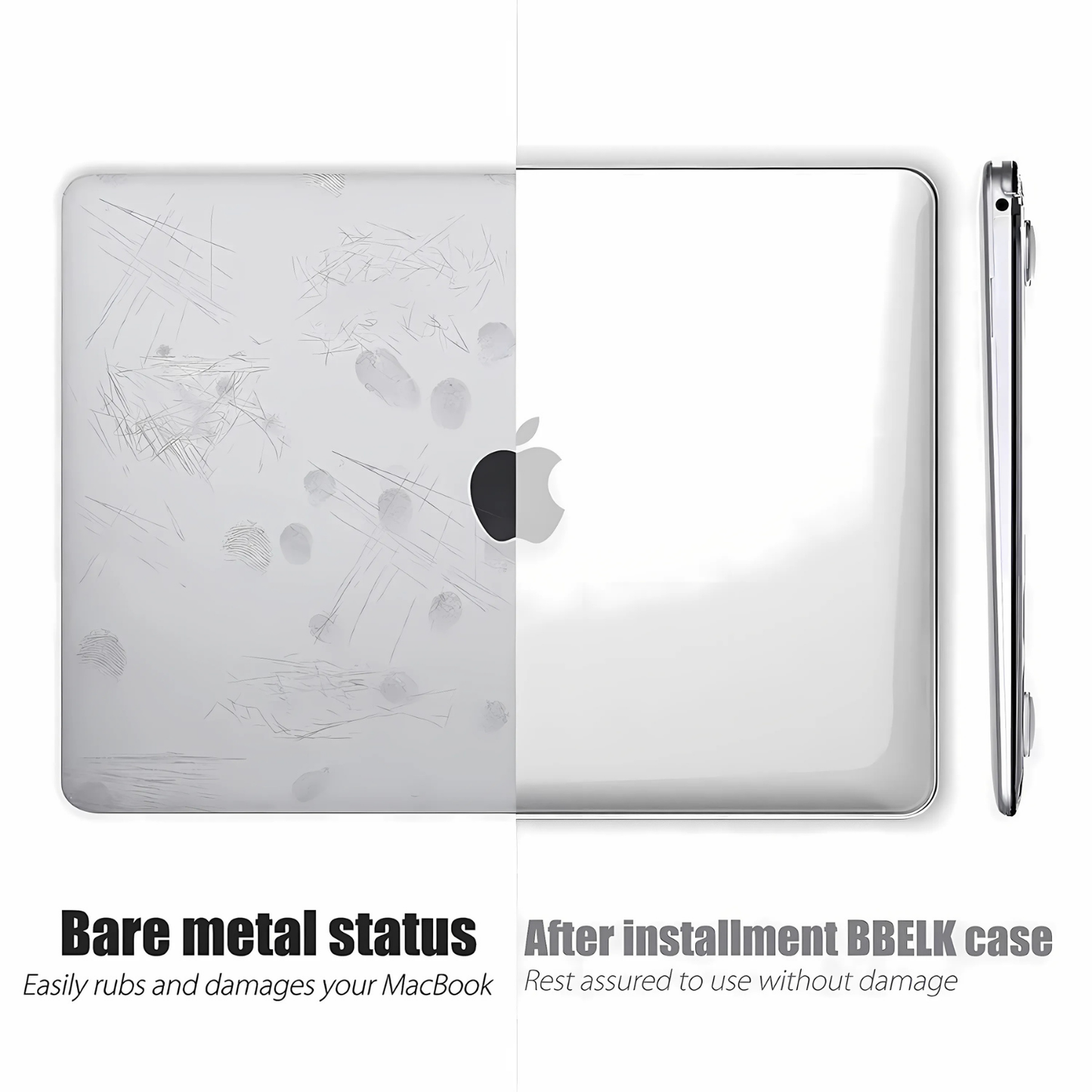 MacBook Crystal Protective Case